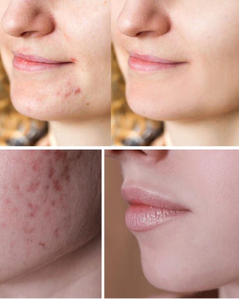 Gesichtsbehandlung Berlin Vorher Nachher